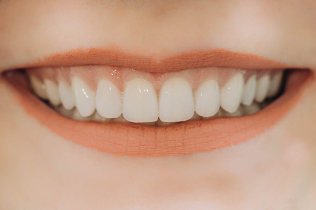 03 Una persona joven con una sonrisa de dientes parejos y blancos